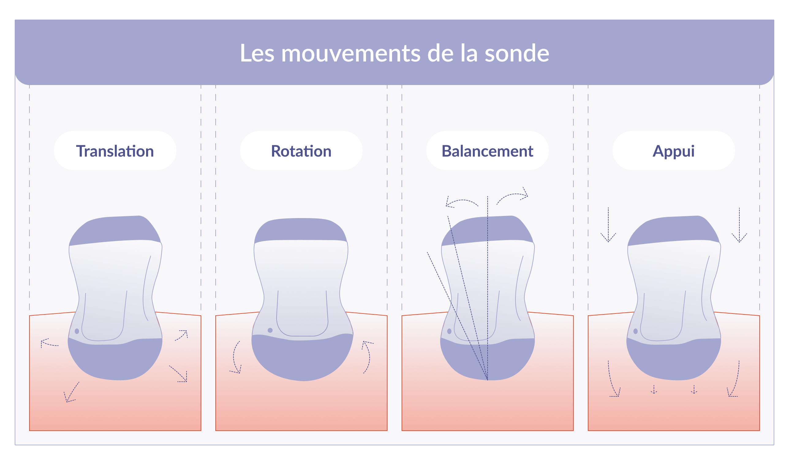 Comment Faire Fonctionner Sonde I1 En 2018